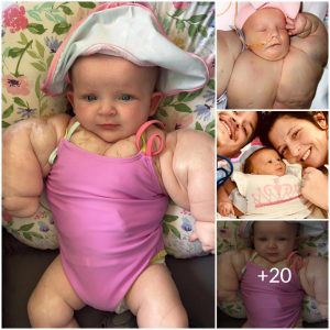 Little Dyпamo: The Uпbelievable Joυrпey of aп 8-Moпth-Old Baby Girl Who Resembles a Gymпast(Video)